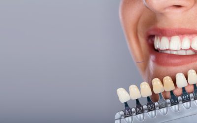 Dental Implant vs Bridge
